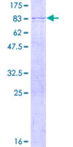 Abnova Human POLR3D Full-length ORF (NP_001713.2, 1 a.a. - 398 a.a.) Recombinant Protein with GST-tag at N-terminal 2 &mu;g | Buy Online | Abnova&trade; | Fisher Scientific