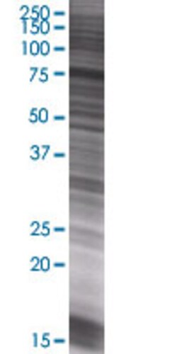 Abnova CAPN5 293T Cell Transient Overexpression Lysate (Denatured) 100 &mu;L | Buy Online | Abnova&trade; | Fisher Scientific
