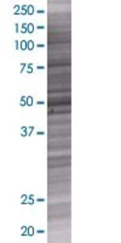 Abnova ZNHIT2 293T Cell Transient Overexpression Lysate (Denatured) 100 &mu;L | Buy Online | Abnova&trade; | Fisher Scientific