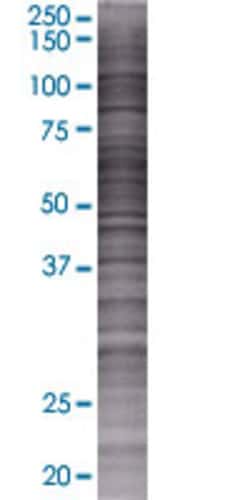 Abnova&trade;&nbsp;CA12 293T Cell Transient Overexpression Lysate (Denatured)