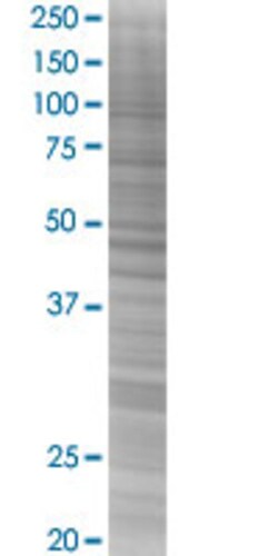 Abnova CALML3 293T Cell Transient Overexpression Lysate (Denatured) (T03) 100 &mu;L | Buy Online | Abnova&trade; | Fisher Scientific