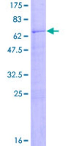 Abnova™ Human CD2 Full-length ORF (NP_001758.1, 1 a.a. - 351 a.a.) Recombinant Protein with GST-tag at N-terminal