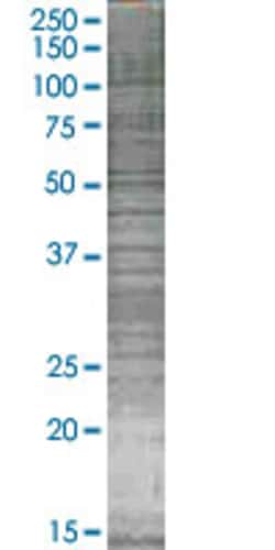 Abnova&trade;&nbsp;CD3D 293T Cell Transient Overexpression Lysate (Denatured)