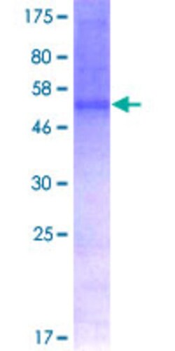 Abnova™ Human CD47 Full-length ORF (NP_001768.1, 1 a.a. - 323 a.a.) Recombinant Protein with GST-tag at N-terminal