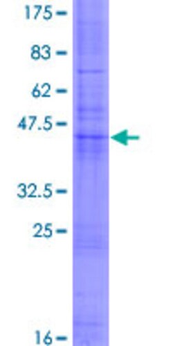 Abnova™ Human CD53 Full-length ORF (NP_000551.1, 1 a.a. - 219 a.a.) Recombinant Protein with GST-tag at N-terminal