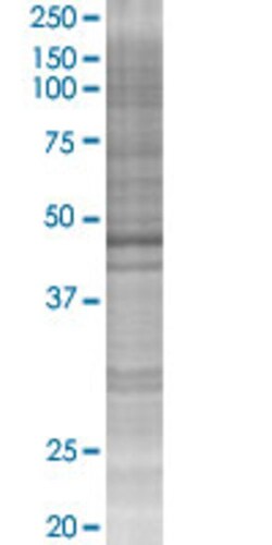 Abnova SEPT7 293T Cell Transient Overexpression Lysate (Denatured) 100 &mu;l | Buy Online | Abnova&trade; | Fisher Scientific