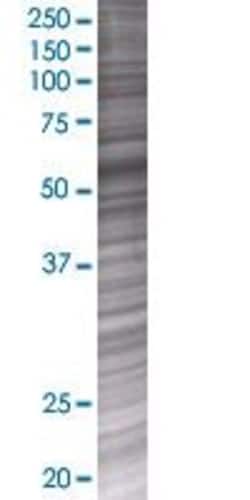 Abnova&trade;&nbsp;CDR2 293T Cell Transient Overexpression Lysate (Denatured)