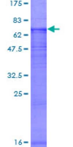 Abnova Human CLCNKB Full-length ORF (AAH20873.1, 1 a.a. - 462 a.a.) Recombinant Protein with GST-tag at N-terminal 2 &mu;g | Buy Online | Abnova&trade; | Fisher Scientific