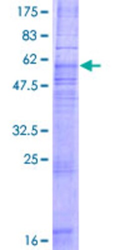Abnova™ Human CCR8 Full-length ORF (NP_005192.1, 1 a.a. - 355 a.a.) Recombinant Protein with GST-tag at N-terminal