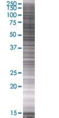 Abnova PLK3 293T Cell Transient Overexpression Lysate (Denatured) 100 &mu;L | Buy Online | Abnova&trade; | Fisher Scientific