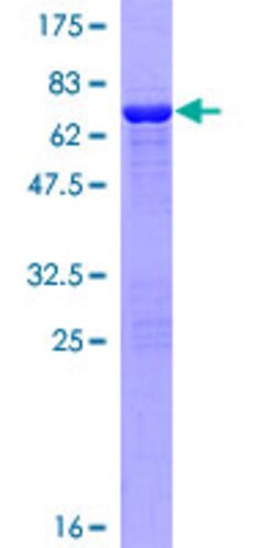 Abnova&trade;&nbsp;Human CNN3 Full-length ORF (NP_001830.1, 1 a.a. - 329 a.a.) Recombinant Protein with GST-tag at N-terminal:  