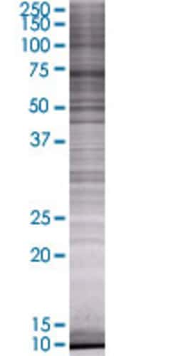 Abnova CPT1A 293T Cell Transient Overexpression Lysate (Denatured) 100 &mu;L | Buy Online | Abnova&trade; | Fisher Scientific
