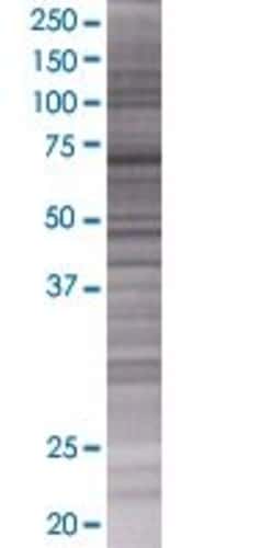 Abnova&trade;&nbsp;CPT2 293T Cell Transient Overexpression Lysate (Denatured)