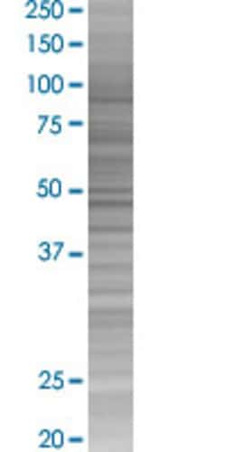 Abnova HAPLN1 293T Cell Transient Overexpression Lysate (Denatured) 100 &mu;L | Buy Online | Abnova&trade; | Fisher Scientific