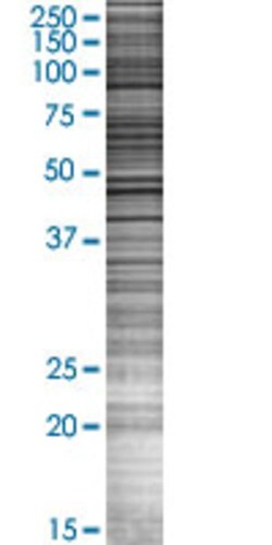 Abnova CRY1 293T Cell Transient Overexpression Lysate (Denatured) 100 &mu;l | Buy Online | Abnova&trade; | Fisher Scientific