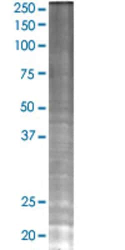 Abnova CSH1 293T Cell Transient Overexpression Lysate (Denatured) 100 &mu;L | Buy Online | Abnova&trade; | Fisher Scientific