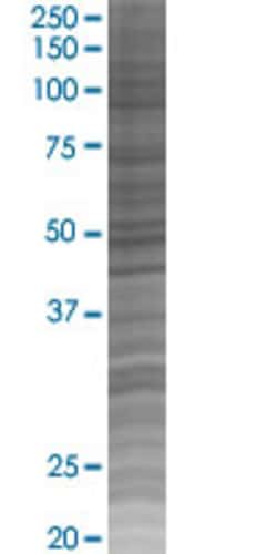 Abnova CSNK2B 293T Cell Transient Overexpression Lysate (Denatured) 100 &mu;L | Buy Online | Abnova&trade; | Fisher Scientific