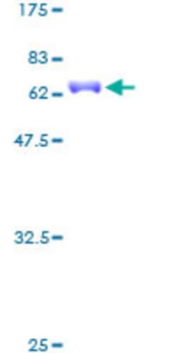 Abnova Human NKX2-5 Full-length ORF (AAH25711, 1 a.a. - 324 a.a.) Recombinant Protein with GST-tag at N-terminal 2 &mu;g | Buy Online | Abnova&trade; | Fisher Scientific