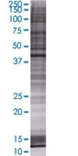 Abnova&trade;&nbsp;CTH 293T Cell Transient Overexpression Lysate (Denatured)