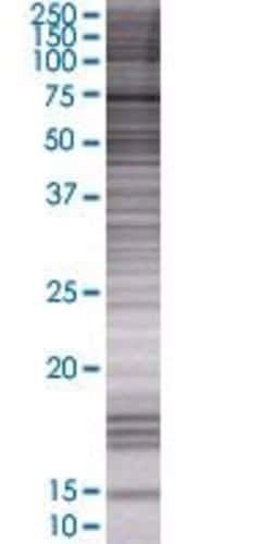 Abnova CXADR 293T Cell Transient Overexpression Lysate (Denatured) 100 &mu;L | Buy Online | Abnova&trade; | Fisher Scientific