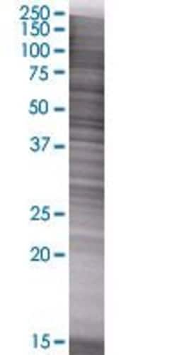 Abnova CYP2C8 293T Cell Transient Overexpression Lysate (Denatured) 100 &mu;L | Buy Online | Abnova&trade; | Fisher Scientific