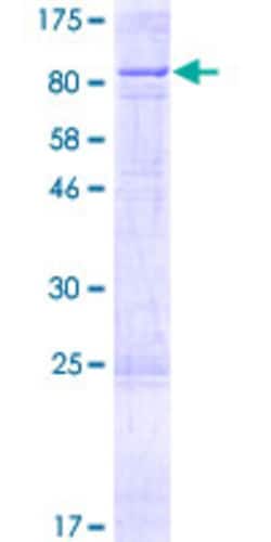 Abnova Human CYP11B1 Full-length ORF (AAH96285.1, 1 a.a. - 574 a.a.) Recombinant Protein with GST-tag at N-terminal 2 &mu;g | Buy Online | Abnova&trade; | Fisher Scientific
