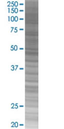 Abnova DAXX 293T Cell Transient Overexpression Lysate (Denatured) 100 &mu;L | Buy Online | Abnova&trade; | Fisher Scientific