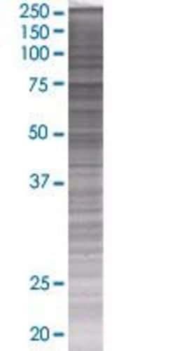 Abnova™ DDX3X 293T Cell Transient Overexpression Lysate (Denatured)