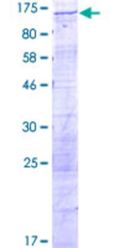 Abnova Human DDX10 Full-length ORF (NP_004389.2, 1 a.a. - 875 a.a.) Recombinant Protein with GST-tag at N-terminal 2 &mu;g | Buy Online | Abnova&trade; | Fisher Scientific