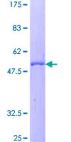 Abnova Human DF Full-length ORF (NP_001919.2, 1 a.a. - 253 a.a.) Recombinant Protein with GST-tag at N-terminal 2 &mu;g | Buy Online | Abnova&trade; | Fisher Scientific