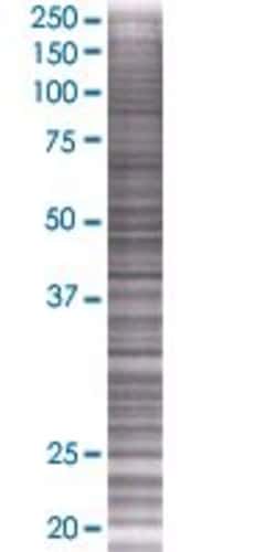 Abnova™ DFNA5 293T Cell Transient Overexpression Lysate (Denatured) (T02)