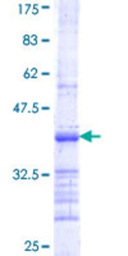 Abnova Human DLST Partial ORF (NP_001924, 1 a.a. - 99 a.a.) Recombinant