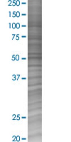 Abnova DLX6 293T Cell Transient Overexpression Lysate (Denatured) 100 &mu;L | Buy Online | Abnova&trade; | Fisher Scientific