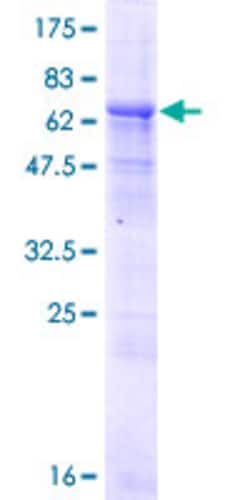 Abnova Human DOM3Z Full-length ORF (NP_005501.2, 1 a.a. - 396 a.a.) Recombinant Protein with GST-tag at N-terminal 25 ug | Buy Online | Abnova&trade; | Fisher Scientific