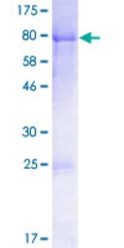 Abnova Human DVL1 Full-length ORF (NP_877580.1, 1 a.a. - 444 a.a.) Recombinant Protein with GST-tag at N-terminal 2 &mu;g | Buy Online | Abnova&trade; | Fisher Scientific