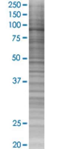 Abnova ELF4 293T Cell Transient Overexpression Lysate (Denatured) 100 &mu;L | Buy Online | Abnova&trade; | Fisher Scientific