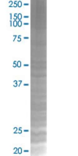 Abnova&trade;&nbsp;EPAS1 293T Cell Transient Overexpression Lysate (Denatured) (T02)
