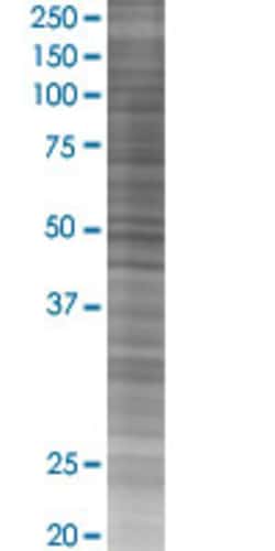 Abnova EXT2 293T Cell Transient Overexpression Lysate (Denatured) (T02) 100 &mu;L | Buy Online | Abnova&trade; | Fisher Scientific