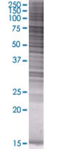 Abnova&trade;&nbsp;ACSL3 293T Cell Transient Overexpression Lysate (Denatured)