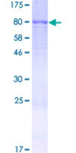 Abnova Human FARSA Full-length ORF (NP_004452.1, 1 a.a. - 508 a.a.) Recombinant Protein with GST-tag at N-terminal 2 &mu;g | Buy Online | Abnova&trade; | Fisher Scientific