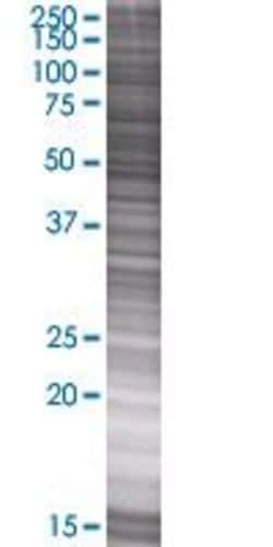 Abnova&trade;&nbsp;FGR 293T Cell Transient Overexpression Lysate (Denatured) (T01)