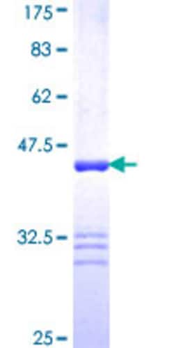 Abnova Human FLNC Partial ORF (NP_001449.3, 2606 a.a. - 2705 a.a.) Recombinant