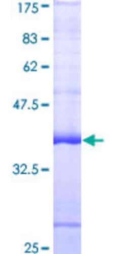 Abnova Human FRK Partial ORF (AAH12916, 391 a.a. - 505 a.a.) Recombinant Protein with GST-tag at N-terminal 25 ug | Buy Online | Abnova&trade; | Fisher Scientific