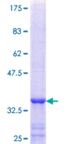 Abnova Human FUCA2 Partial ORF (NP_114409.2, 368 a.a. - 466 a.a.) Recombinant
