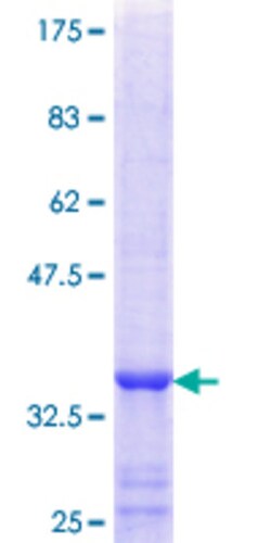 Abnova&trade;&nbsp;Human FUCA2 Partial ORF (NP_114409.2, 368 a.a. - 466 a.a.) Recombinant Protein with GST-tag at N-terminal 25&mu;g 