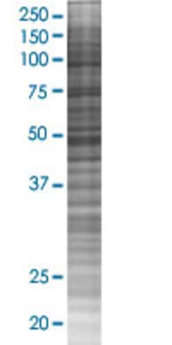 Abnova NR2E3 293T Cell Transient Overexpression Lysate (Denatured) 100 &mu;L | Buy Online | Abnova&trade; | Fisher Scientific
