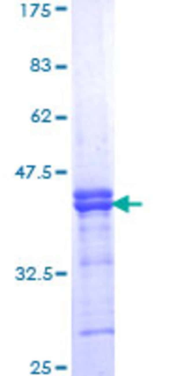 Abnovahuman Gak Partial Orf Aah08668 151 A A 250 A A Recombinant Fisher Scientific<script async src=