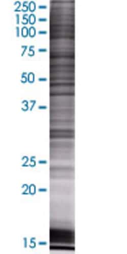 Abnova&trade;&nbsp;B4GALNT1 293T Cell Transient Overexpression Lysate (Denatured)
