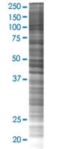 Abnova SAE1 293T Cell Transient Overexpression Lysate (Denatured) 100 &mu;L | Buy Online | Abnova&trade; | Fisher Scientific