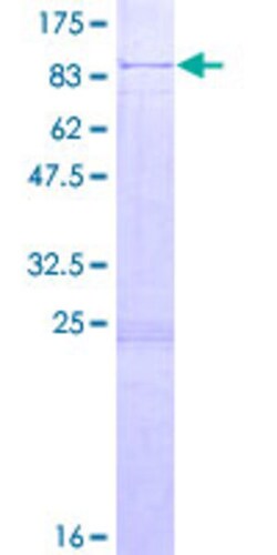 Abnova Human USH1C Full-length ORF (AAH16057.1, 1 a.a. - 533 a.a.) Recombinant Protein with GST-tag at N-terminal 2 &mu;g | Buy Online | Abnova&trade; | Fisher Scientific
